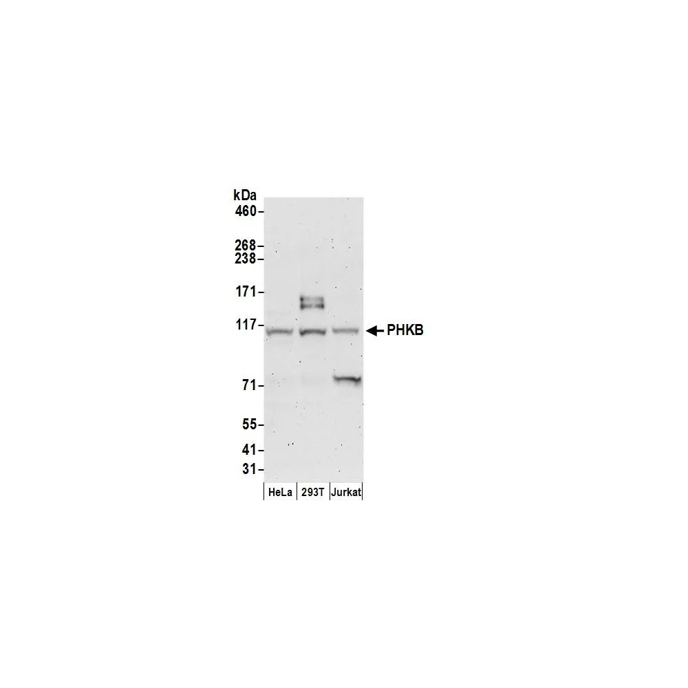 Rabbit anti-PHKB Antibody, Affinity Purified
