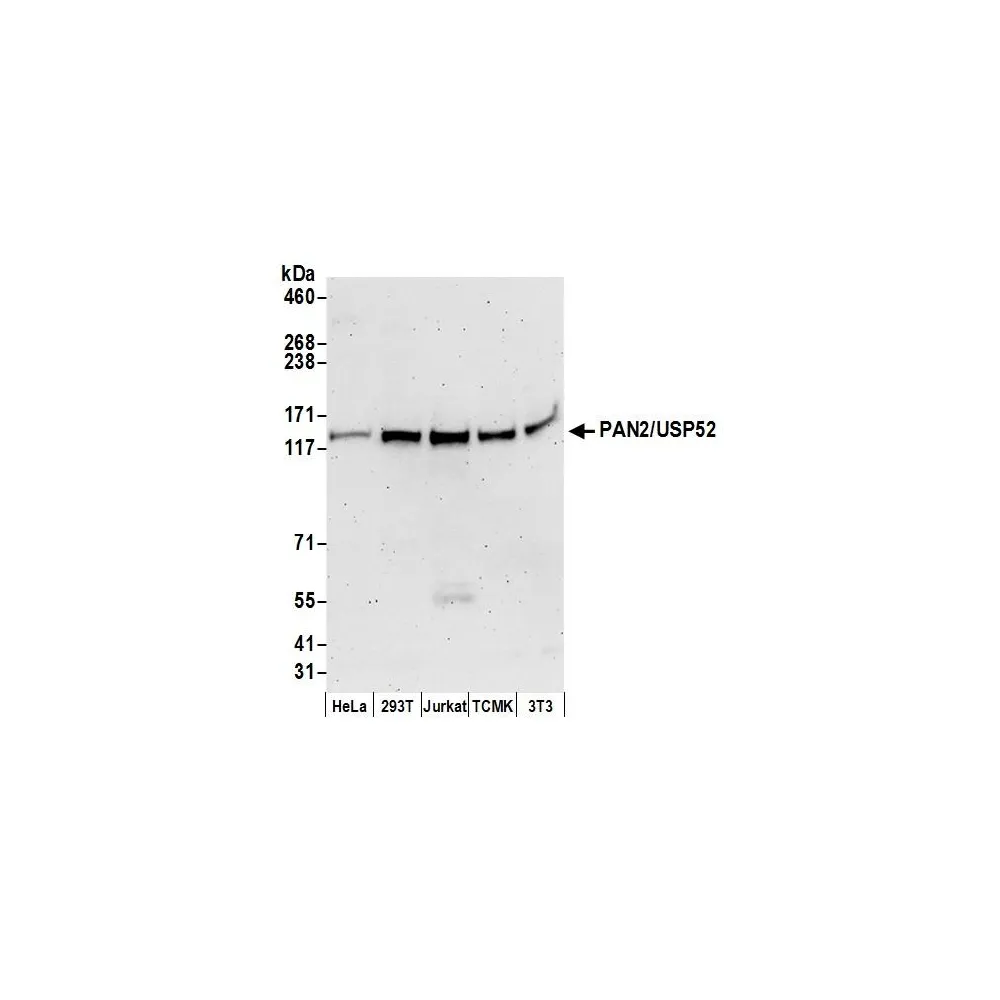 Rabbit anti-PAN2/USP52 Antibody, Affinity Purified