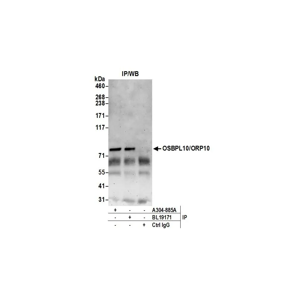 Rabbit anti-OSBPL10/ORP10 Antibody, Affinity Purified
