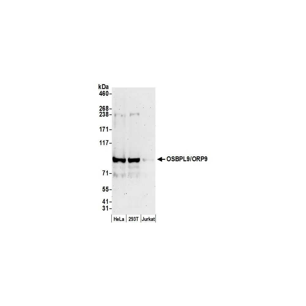 Rabbit anti-OSBPL9/ORP9 Antibody, Affinity Purified
