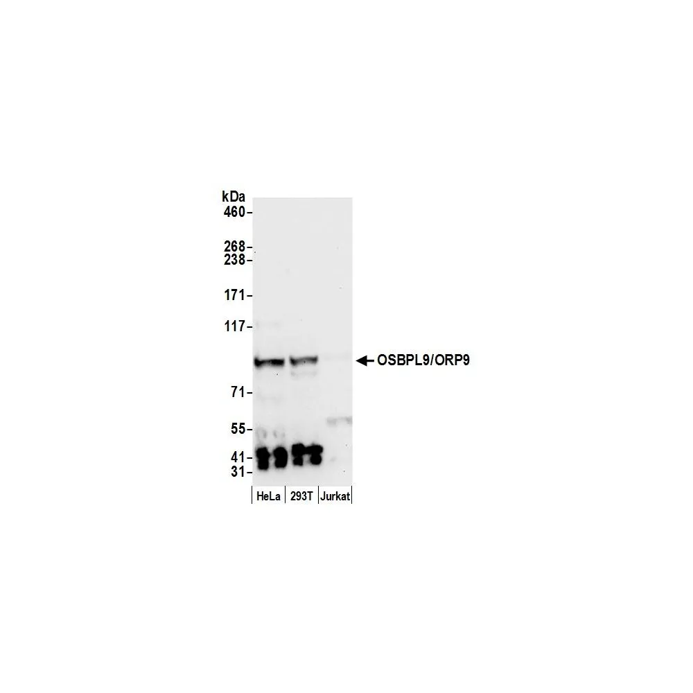 Rabbit anti-OSBPL9/ORP9 Antibody, Affinity Purified
