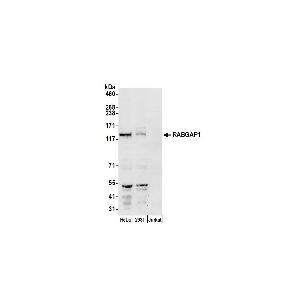 Rabbit anti-RABGAP1 Antibody, Affinity Purified