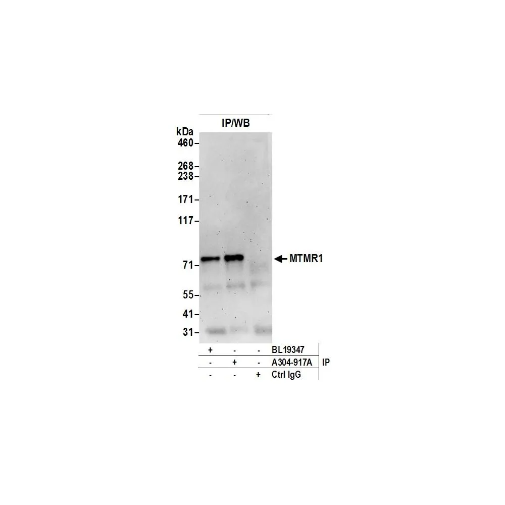 Rabbit anti-MTMR1 Antibody, Affinity Purified