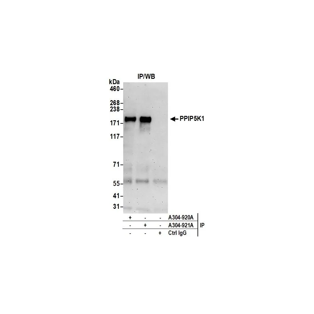 Rabbit anti-PPIP5K1/HISPPD2A Antibody, Affinity Purified