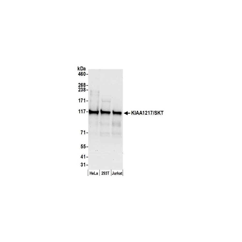 Rabbit anti-KIAA1217/SKT Antibody, Affinity Purified