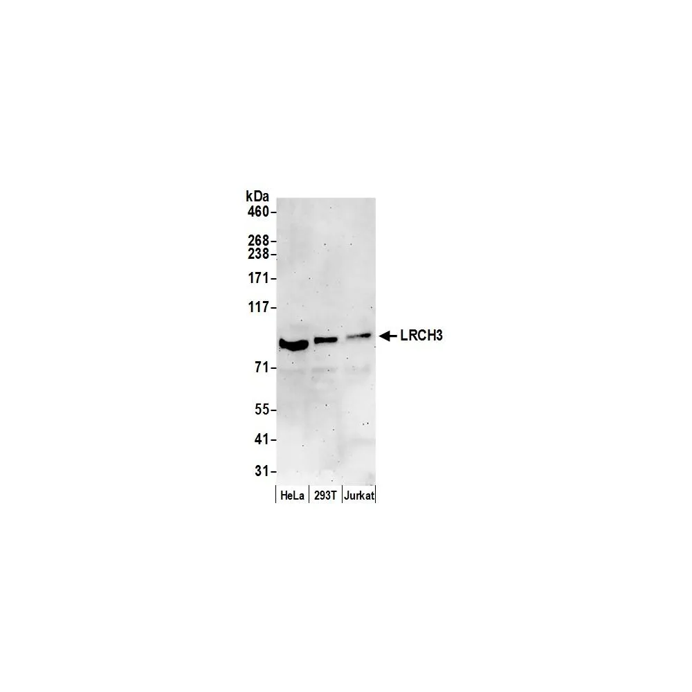 Rabbit anti-LRCH3 Antibody, Affinity Purified