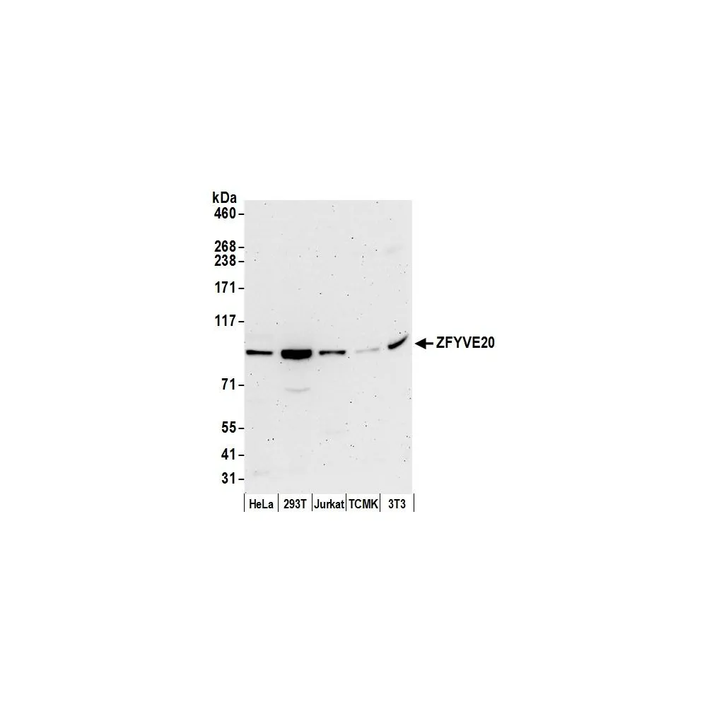Rabbit anti-ZFYVE20/Rabenosyn 5 Antibody, Affinity Purified