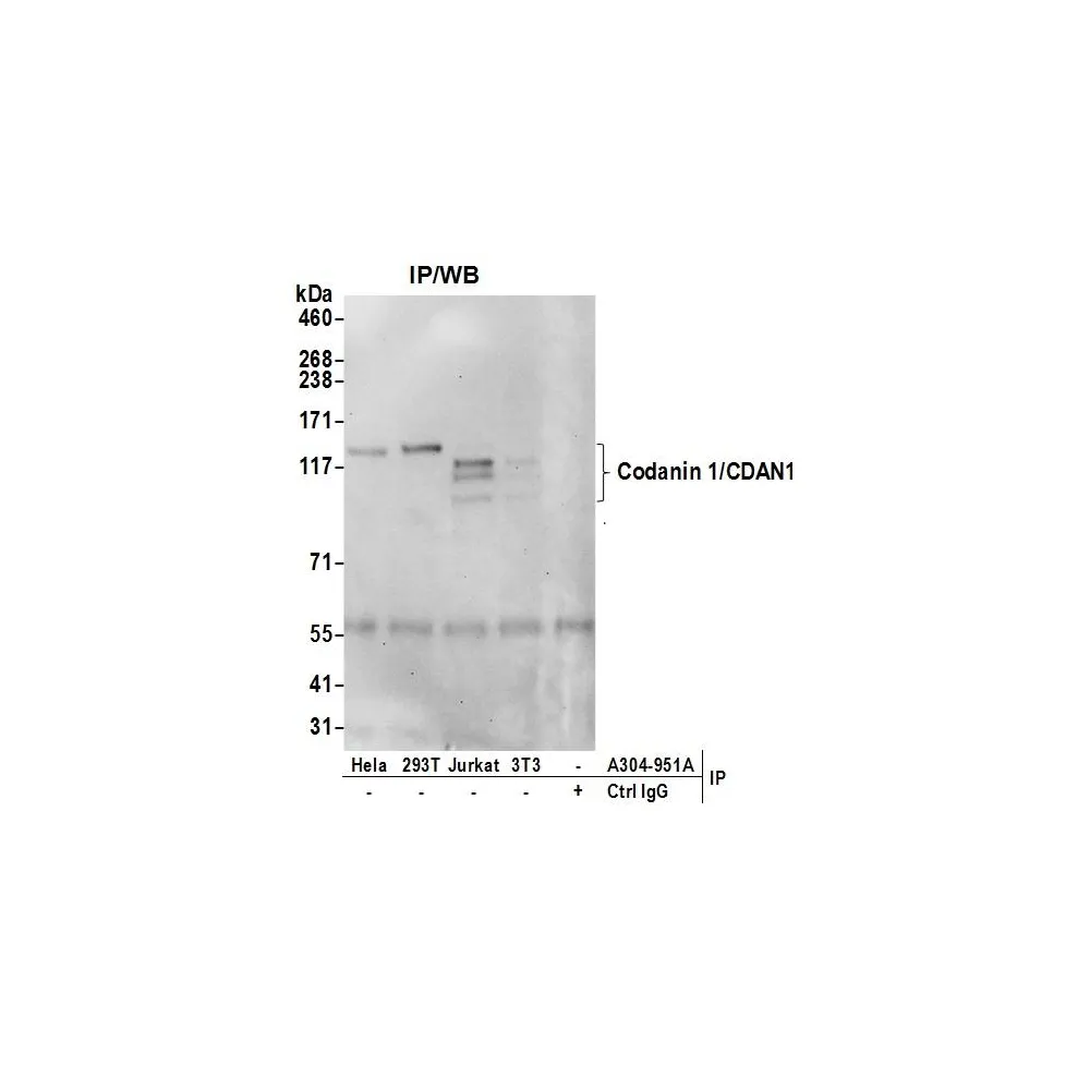 Rabbit anti-Codanin 1/CDAN1 Antibody, Affinity Purified
