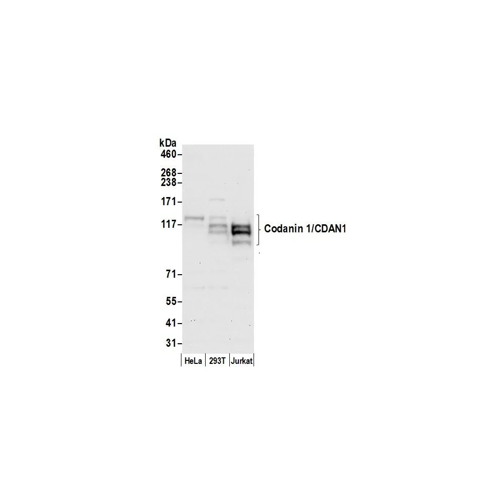Rabbit anti-Codanin 1/CDAN1 Antibody, Affinity Purified