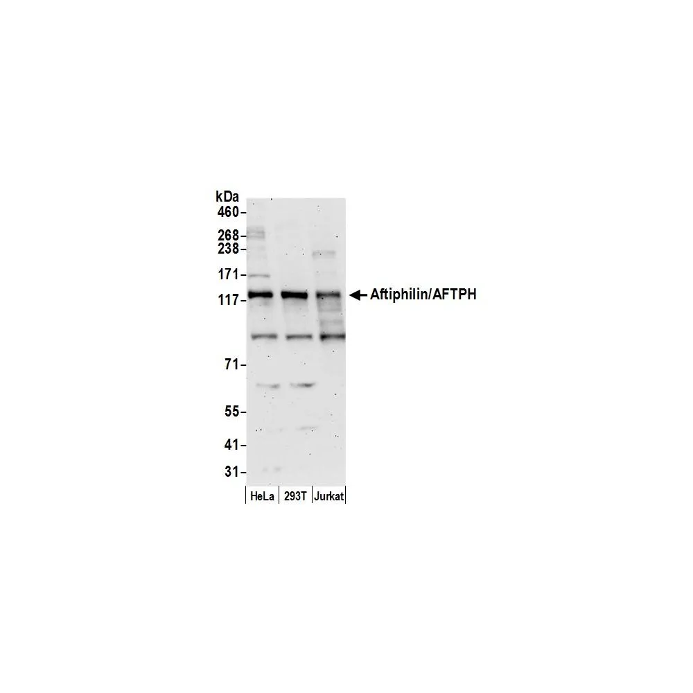 Rabbit anti-Aftiphilin/AFTPH Antibody, Affinity Purified