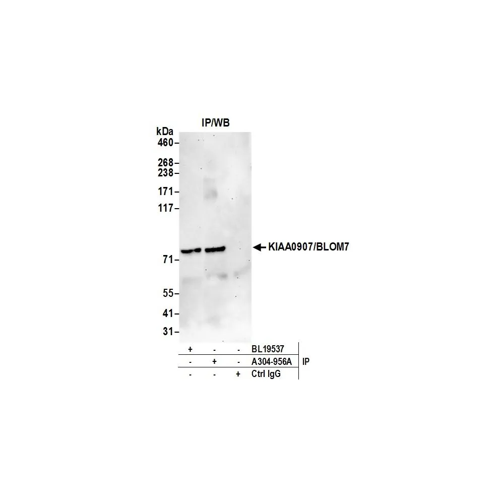 Rabbit anti-KIAA0907/BLOM7 Antibody, Affinity Purified