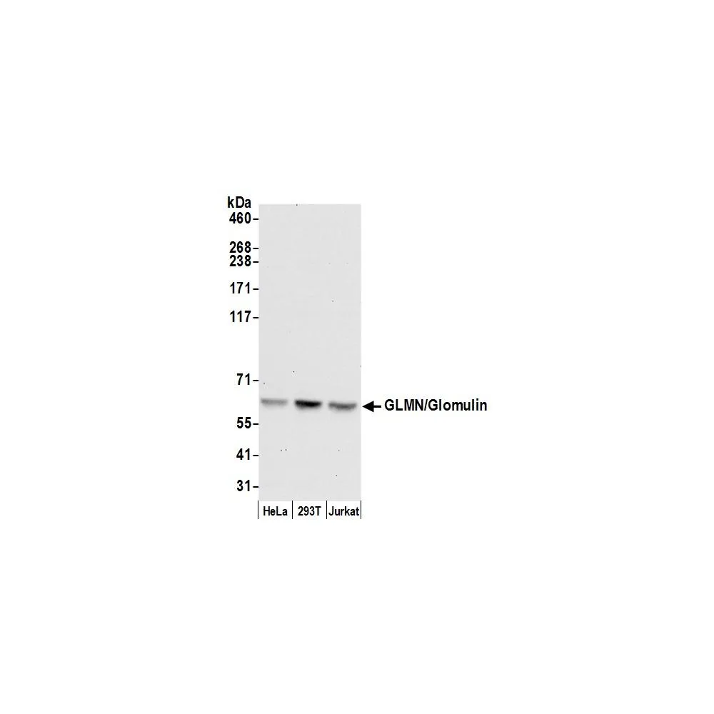 Rabbit anti-GLMN/Glomulin Antibody, Affinity Purified