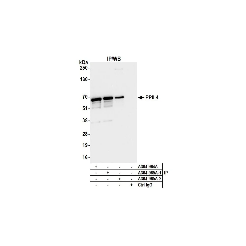 Rabbit anti-PPIL4 Antibody, Affinity Purified