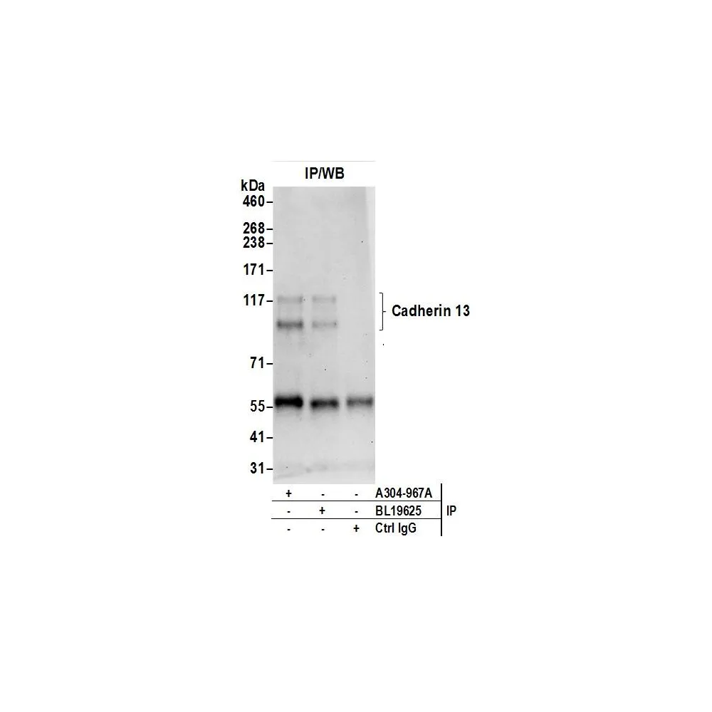 Rabbit anti-Cadherin 13/CDH13/T-cadherin Antibody, Affinity Purified
