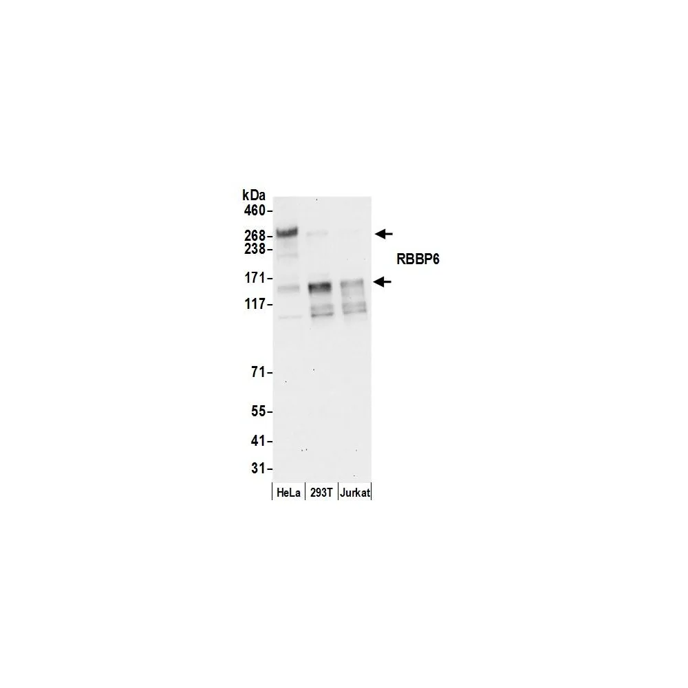 Rabbit anti-RBBP6 Antibody, Affinity Purified