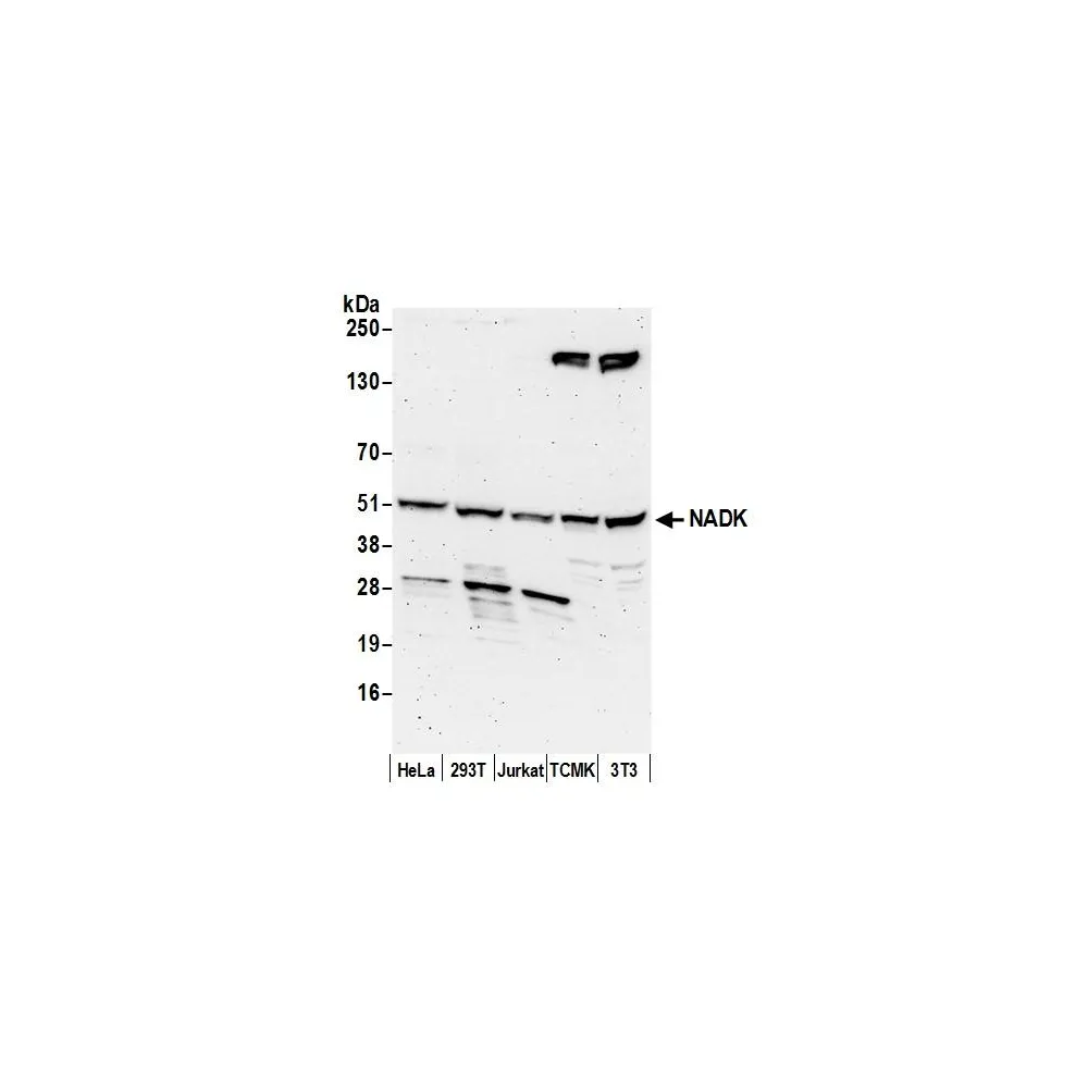 Rabbit anti-NADK Antibody, Affinity Purified