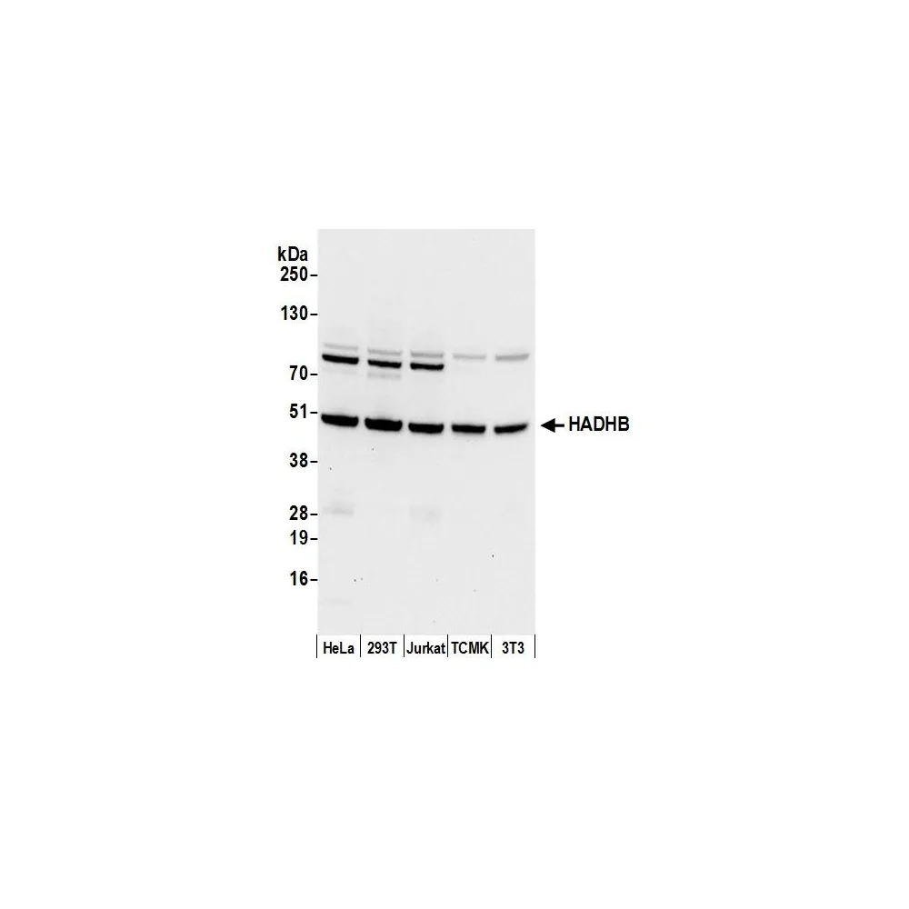 Rabbit anti-HADHB Antibody, Affinity Purified