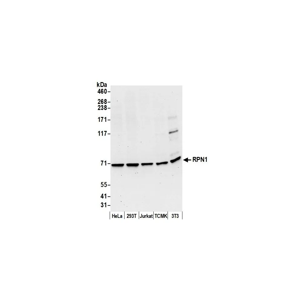 Rabbit anti-RPN1/Ribophorin I Antibody, Affinity Purified