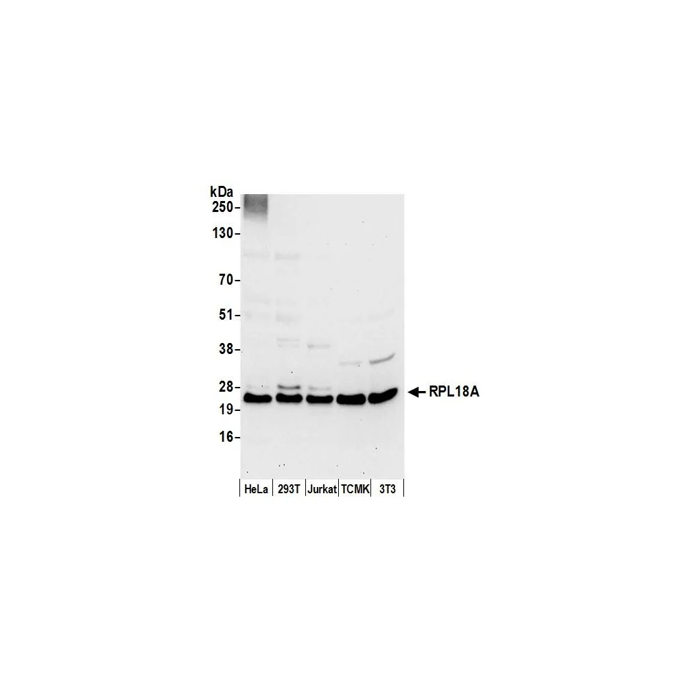 Rabbit anti-RPL18A/Ribosomal Protein L18a Antibody, Affinity Purified