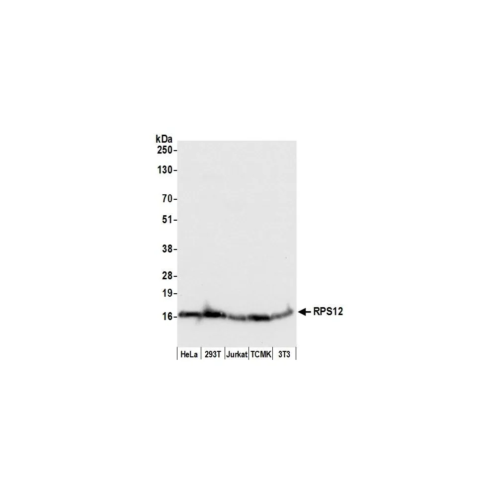 Rabbit anti-RPS12/Ribosomal Protein S12 Antibody, Affinity Purified