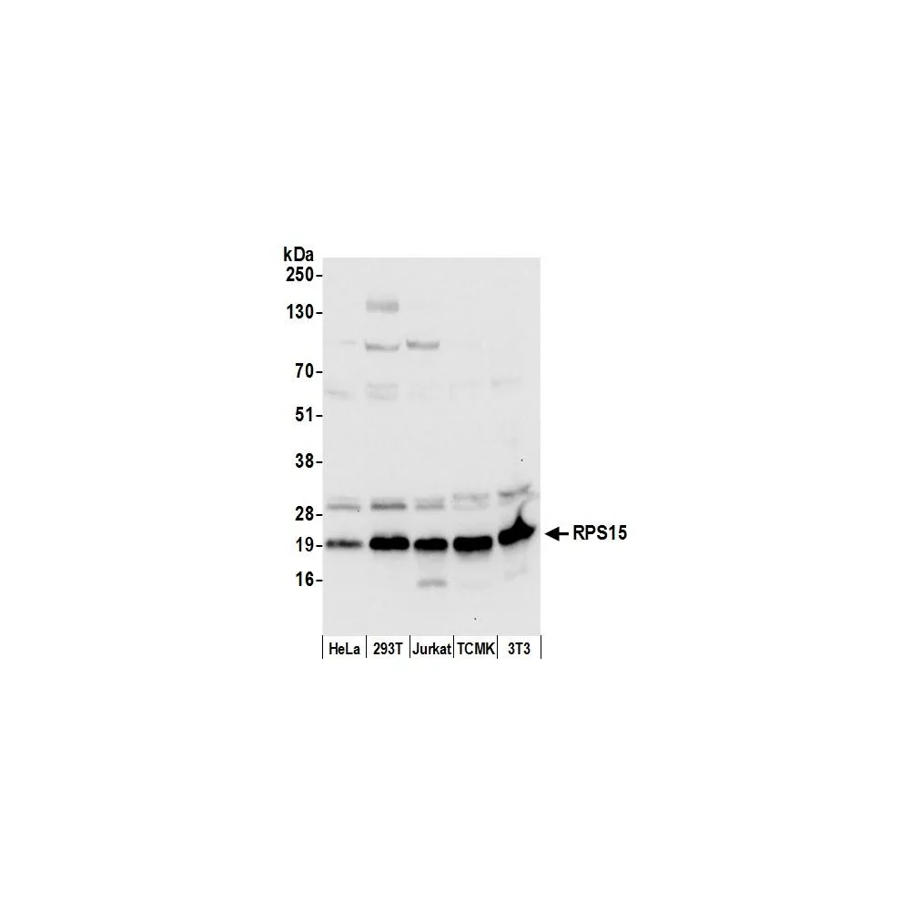 Rabbit anti-RPS15/Ribosomal Protein S15 Antibody, Affinity Purified