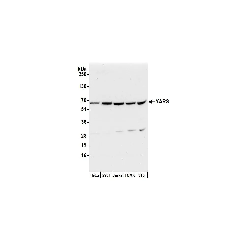 Rabbit anti-YARS/Tyrosyl-tRNA Synthetase/TYRRS Antibody, Affinity Purified