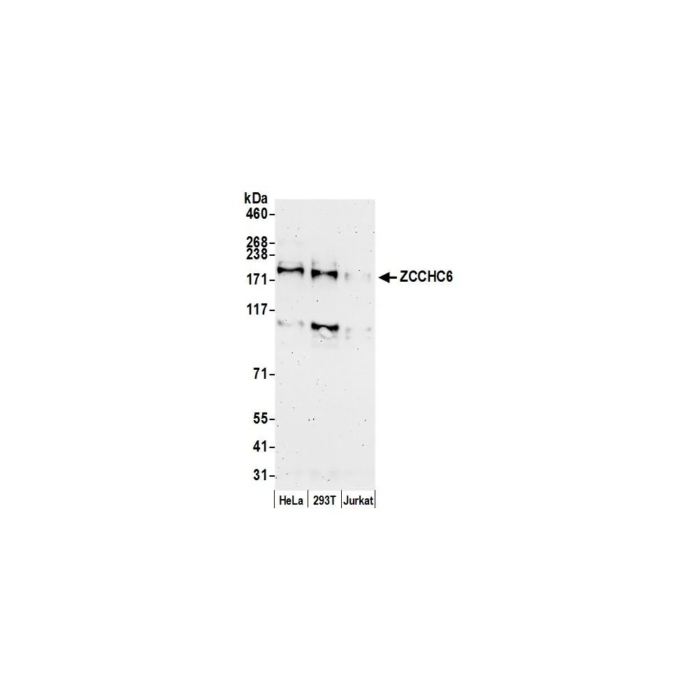 Rabbit anti-ZCCHC6 Antibody, Affinity Purified