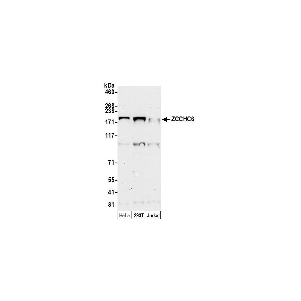 Rabbit anti-ZCCHC6 Antibody, Affinity Purified