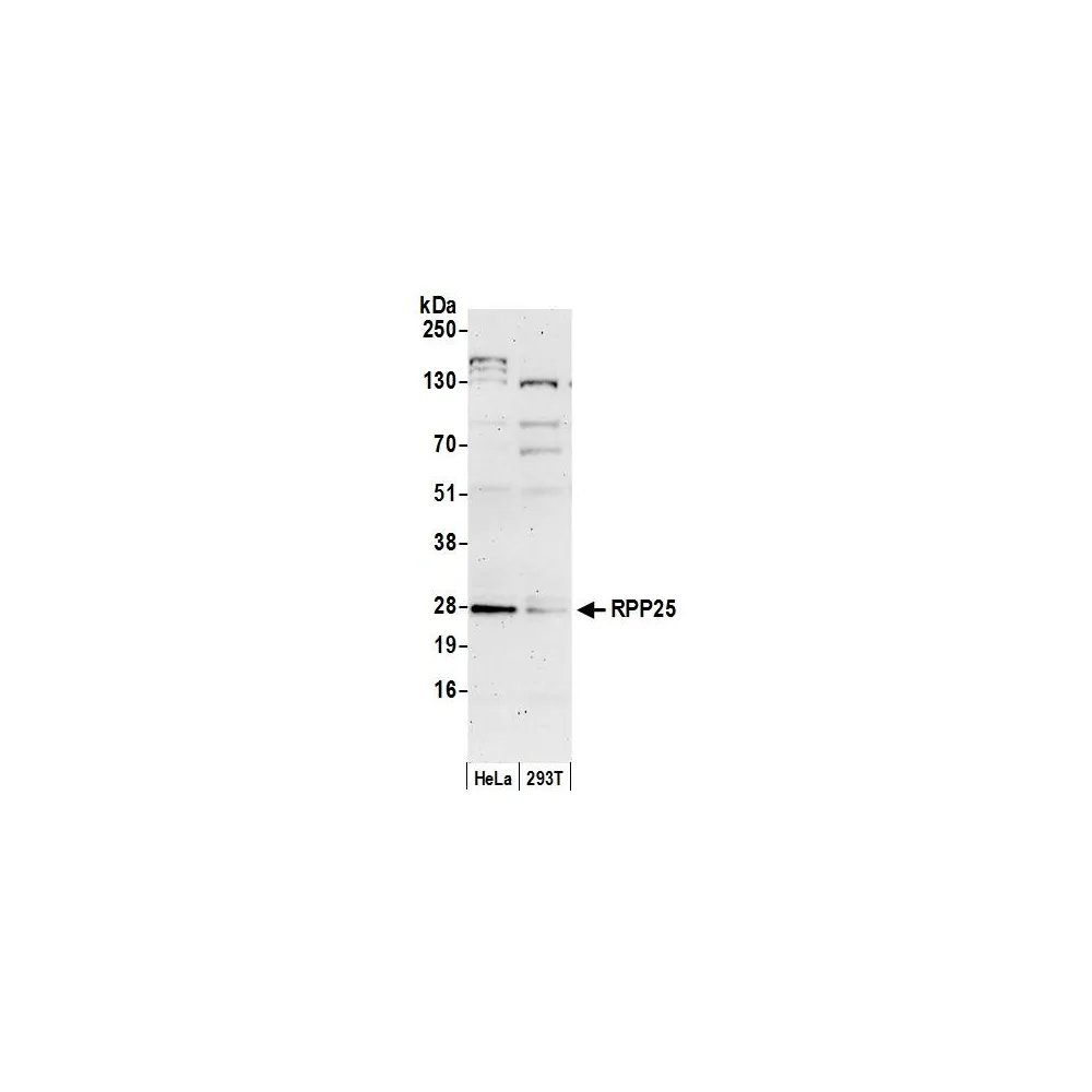 Rabbit anti-RPP25 Antibody, Affinity Purified
