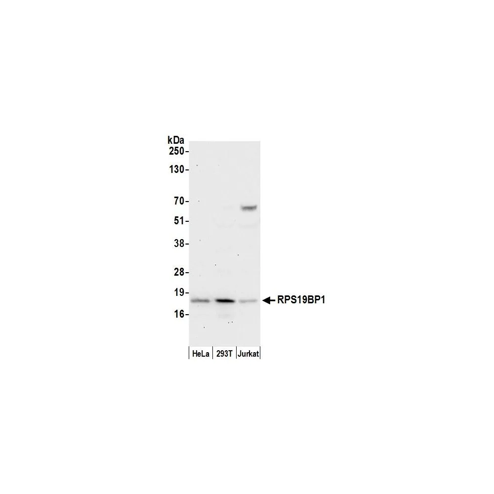 Rabbit anti-RPS19BP1/AROS Antibody, Affinity Purified