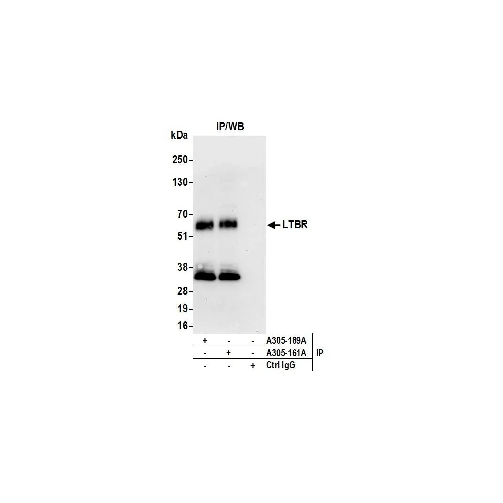 Rabbit anti-LTBR/Lymphotoxin-beta Receptor Antibody, Affinity Purified