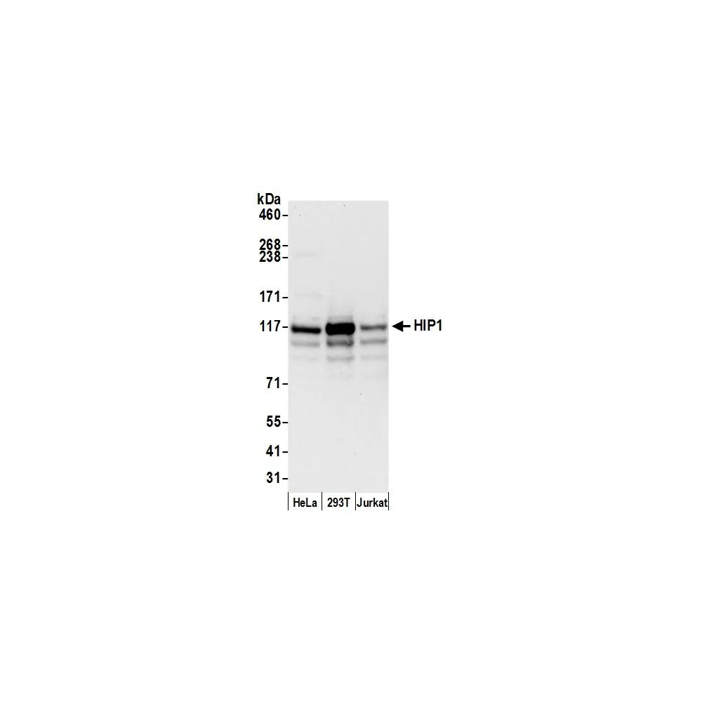 Rabbit anti-HIP1/Huntingtin-interacting Protein 1 Antibody, Affinity Purified