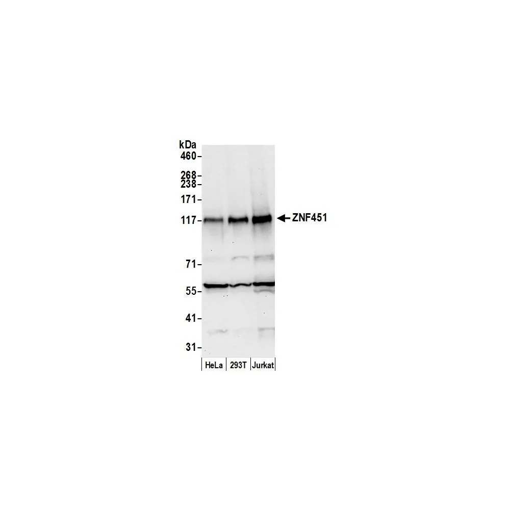 Rabbit anti-ZNF451 Antibody, Affinity Purified