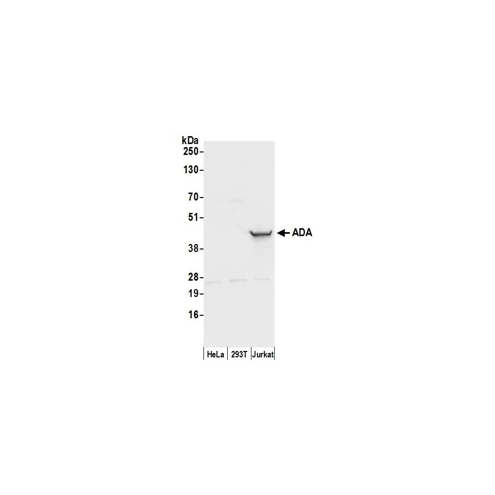 Rabbit anti-ADA/Adenosine Deaminase Antibody, Affinity Purified