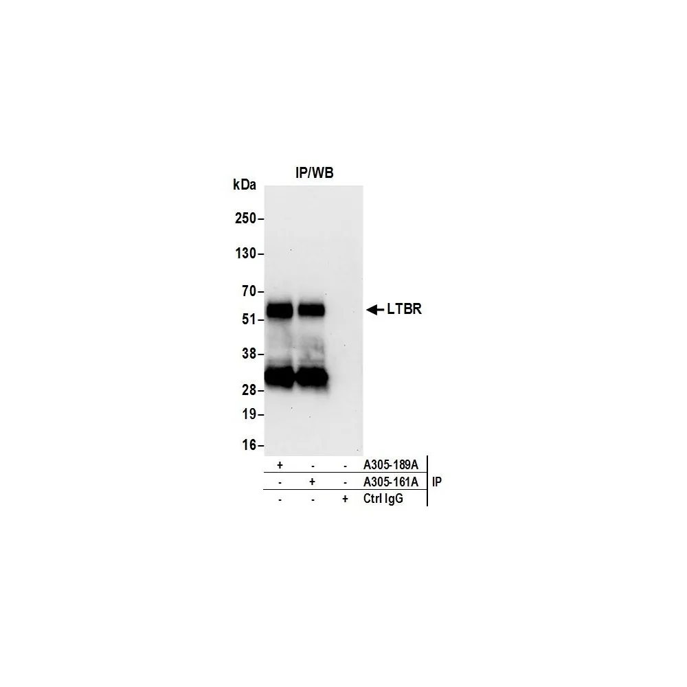 Rabbit anti-LTBR/Lymphotoxin-beta Receptor Antibody, Affinity Purified