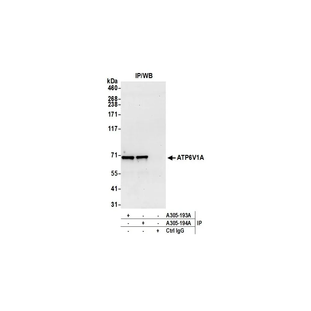 Rabbit anti-ATP6V1A Antibody, Affinity Purified