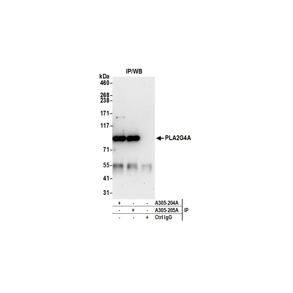 Rabbit anti-PLA2G4A/cPLA2 Antibody, Affinity Purified