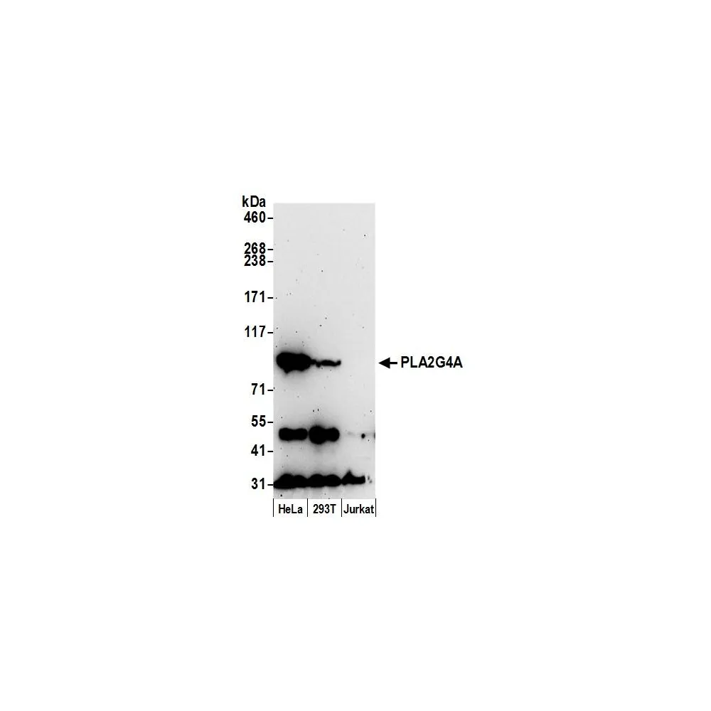 Rabbit anti-PLA2G4A/cPLA2 Antibody, Affinity Purified