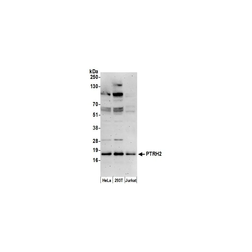 Rabbit anti-PTRH2/BIT1 Antibody, Affinity Purified
