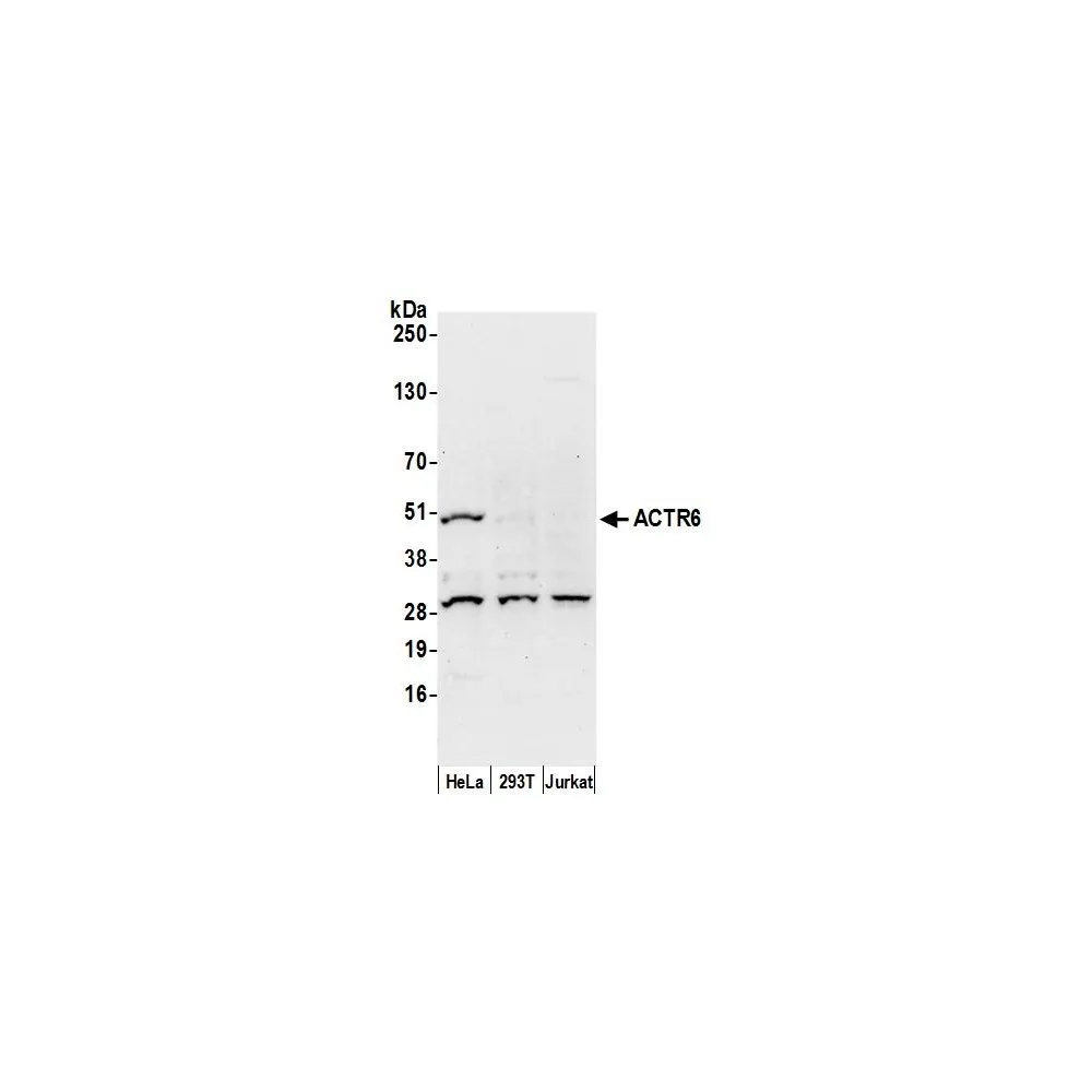 Rabbit anti-ACTR6 Antibody, Affinity Purified