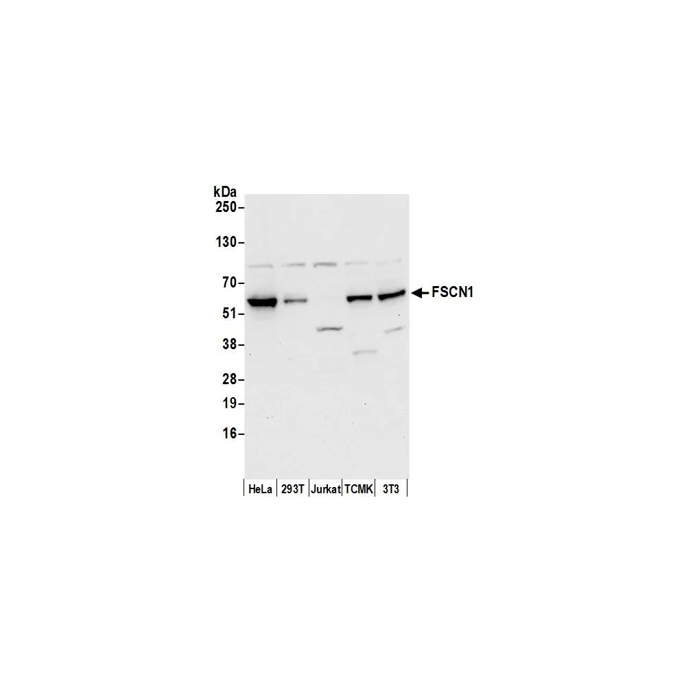 Rabbit anti-FSCN1 Antibody, Affinity Purified