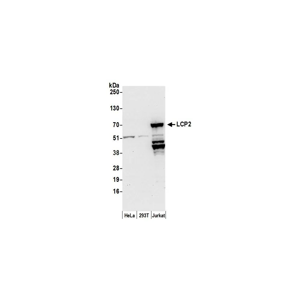 Rabbit anti-LCP2/SLP76 Antibody, Affinity Purified