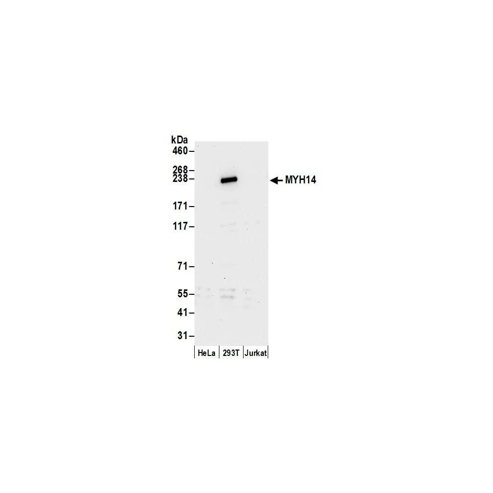 Rabbit anti-MYH14/Myosin-14 Antibody, Affinity Purified