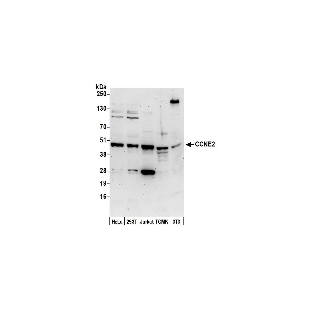 Rabbit anti-CCNE2/Cyclin E2 Antibody, Affinity Purified