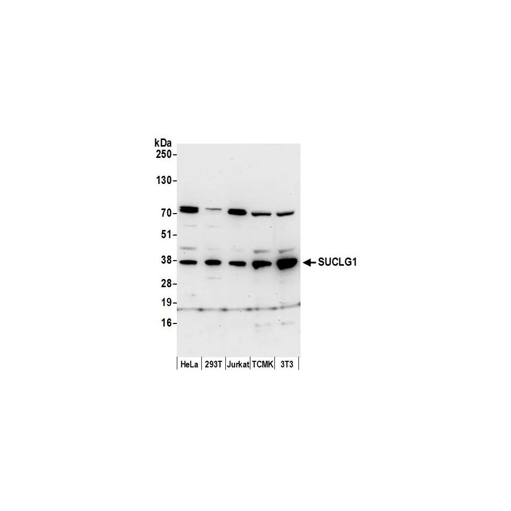 Rabbit anti-SUCLG1 Antibody, Affinity Purified
