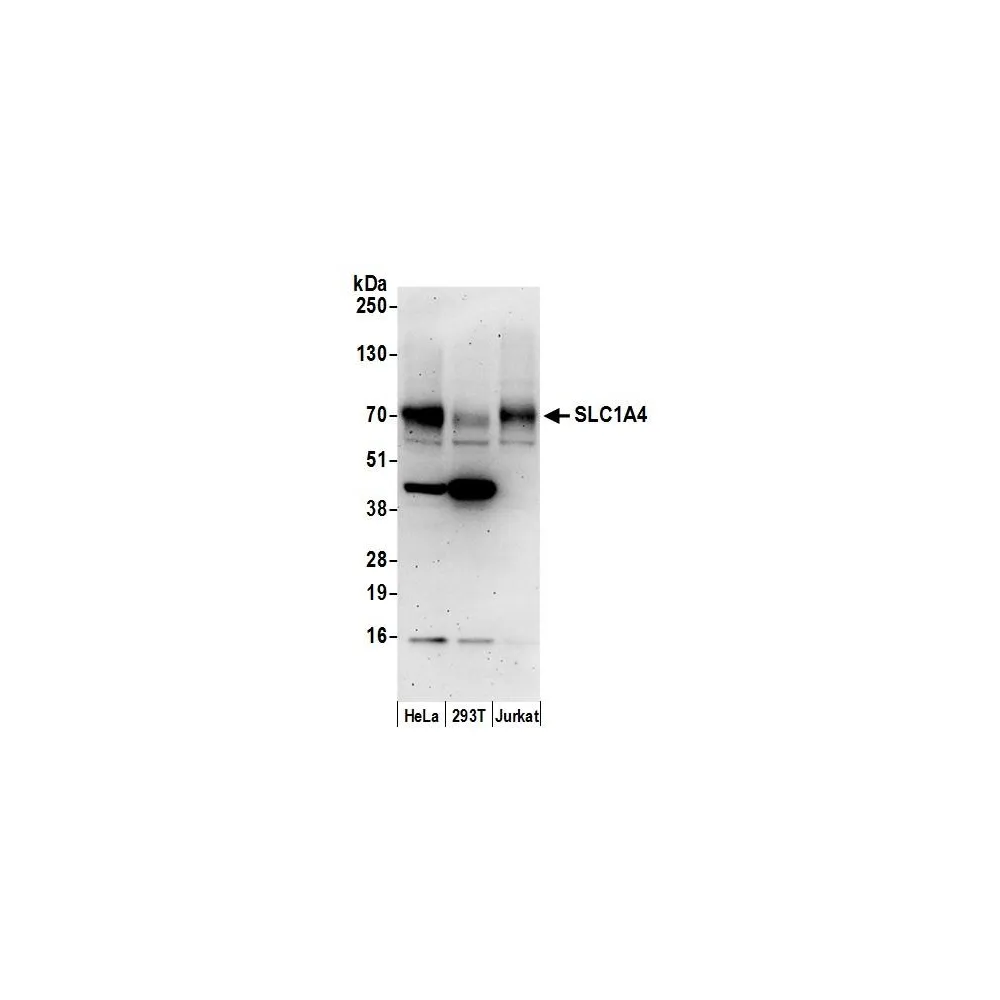 Rabbit anti-SLC1A4/ASCT1 Antibody, Affinity Purified