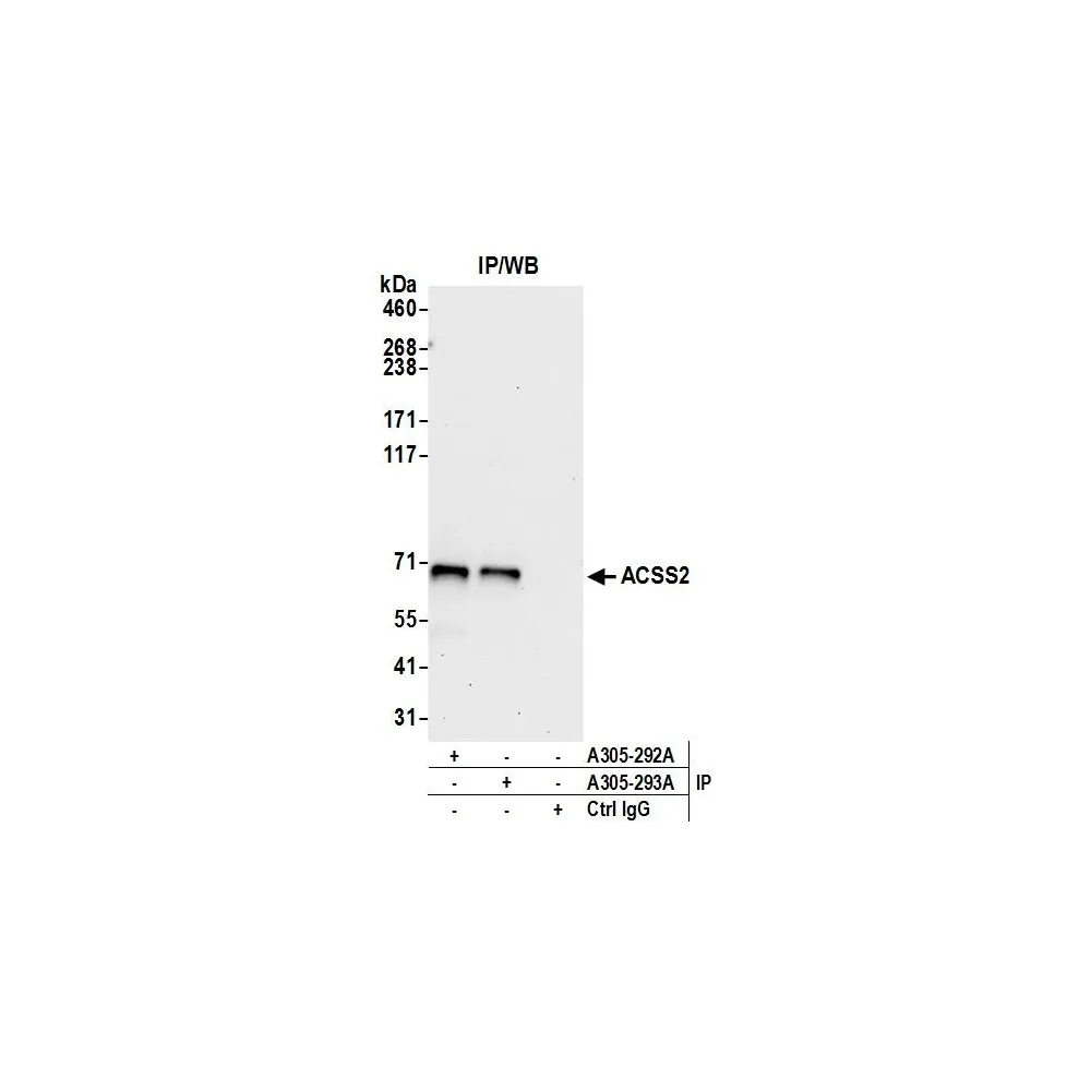 Rabbit anti-ACSS2/ACS Antibody, Affinity Purified