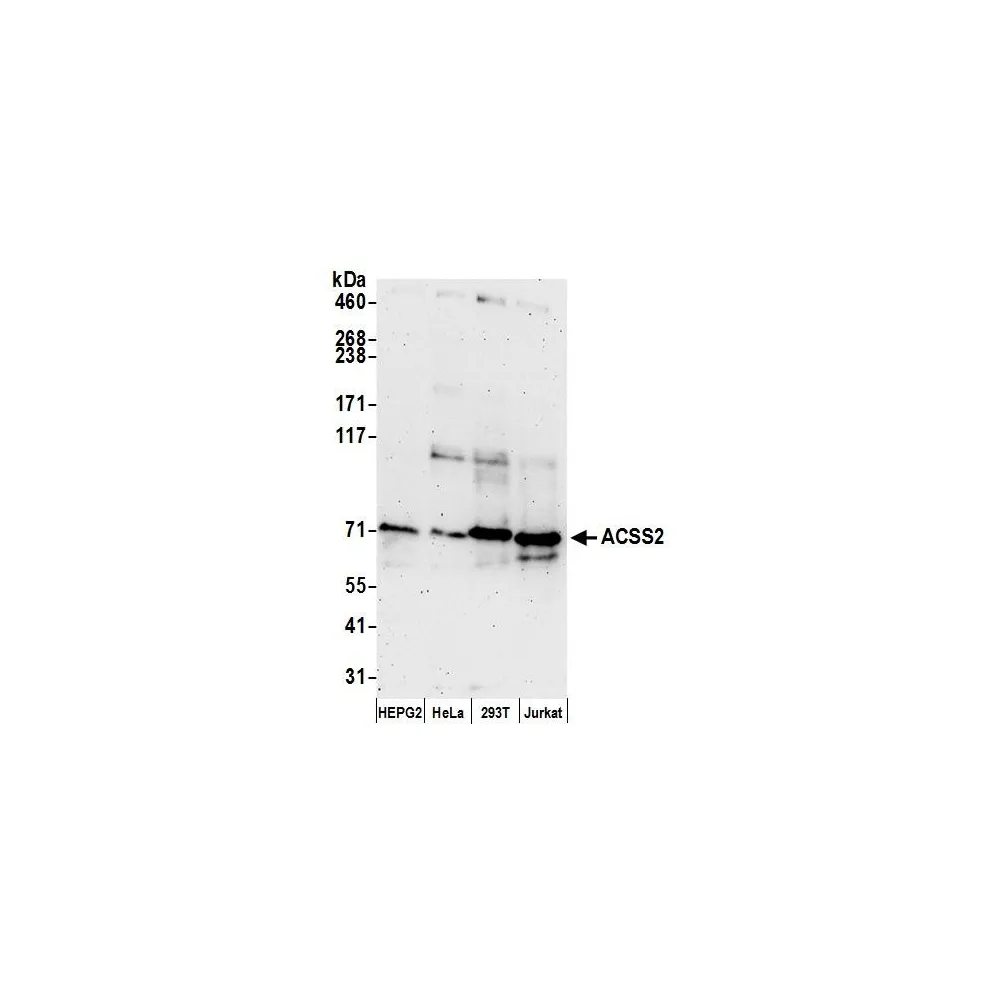 Rabbit anti-ACSS2/ACS Antibody, Affinity Purified