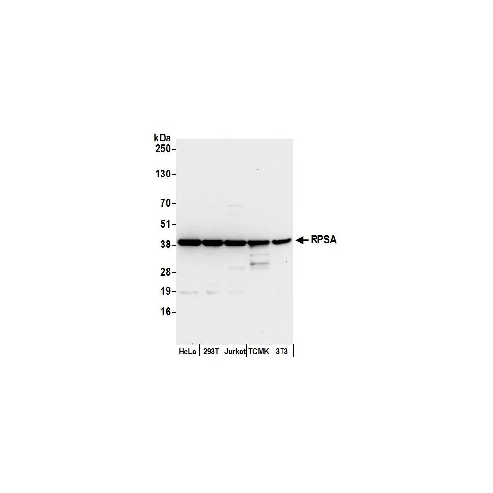 Rabbit anti-RPSA Antibody, Affinity Purified