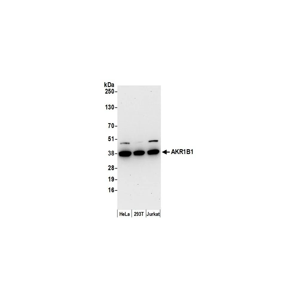 Rabbit anti-AKR1B1 Antibody, Affinity Purified